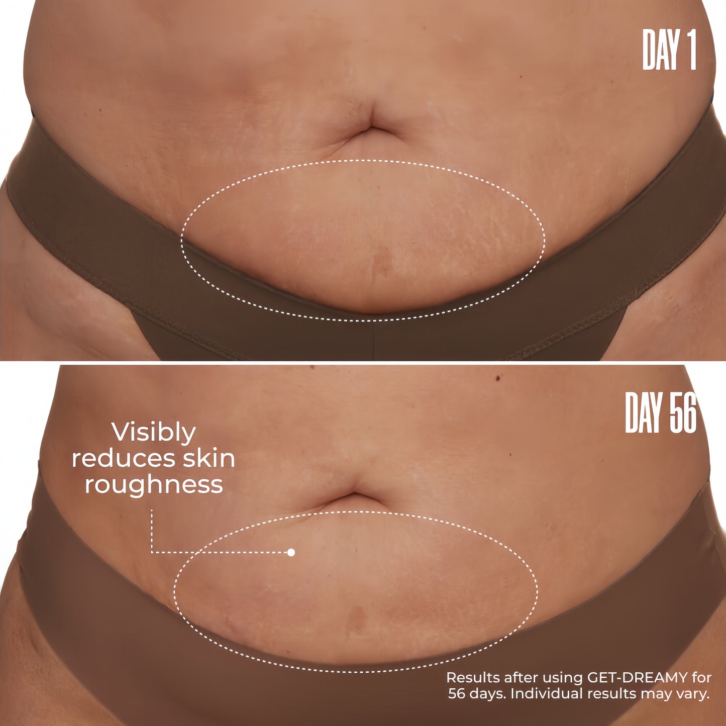 GET-DREAMY Overnight Toning Body Whip